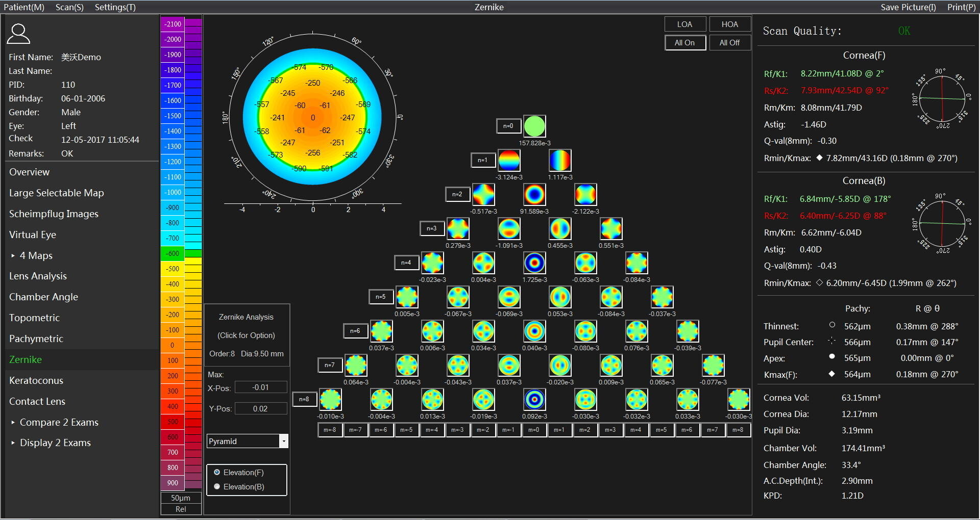 A detailed corneal topography analysis is displayed on a computer screen with multiple color-coded maps, numerical data and pie charts illustrating the shape and thickness of the cornea of a patient named John Doe.