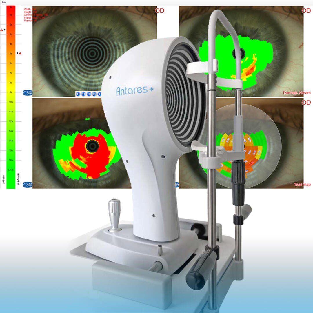 Im Vordergrund ist ein Hornhauttopograph zu sehen, während im Hintergrund diagnostische Karten und Nahaufnahmen von Augen mit farbigen Datenanalysen auf Bildschirmen angezeigt werden.