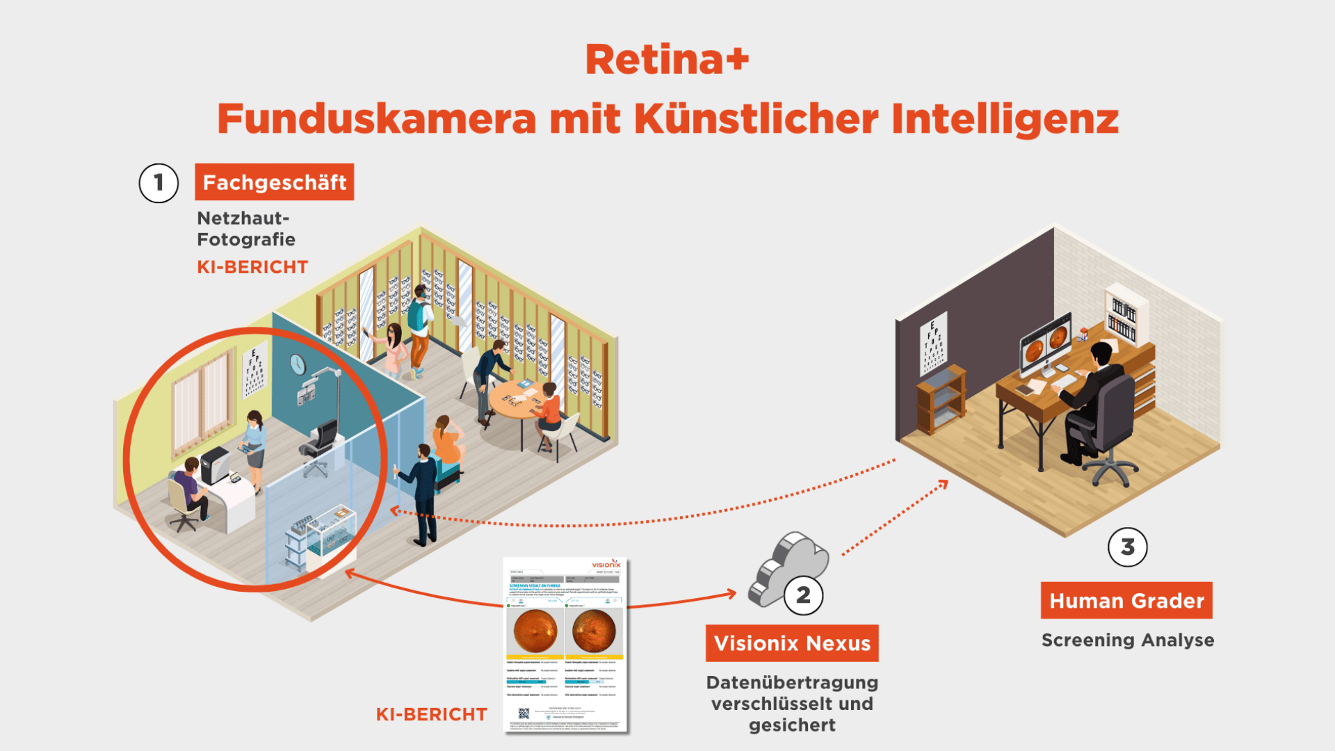 Abbildung zeigt den Arbeitsablauf der KI-basierten Funduskamera Retina+: 1) Augenuntersuchung im Geschäft, 2) Sichere Datenübertragung über Visionix Nexus, 3) Überprüfung der Ergebnisse durch einen Experten. KI-generierter Bericht wird im Prozess angezeigt.