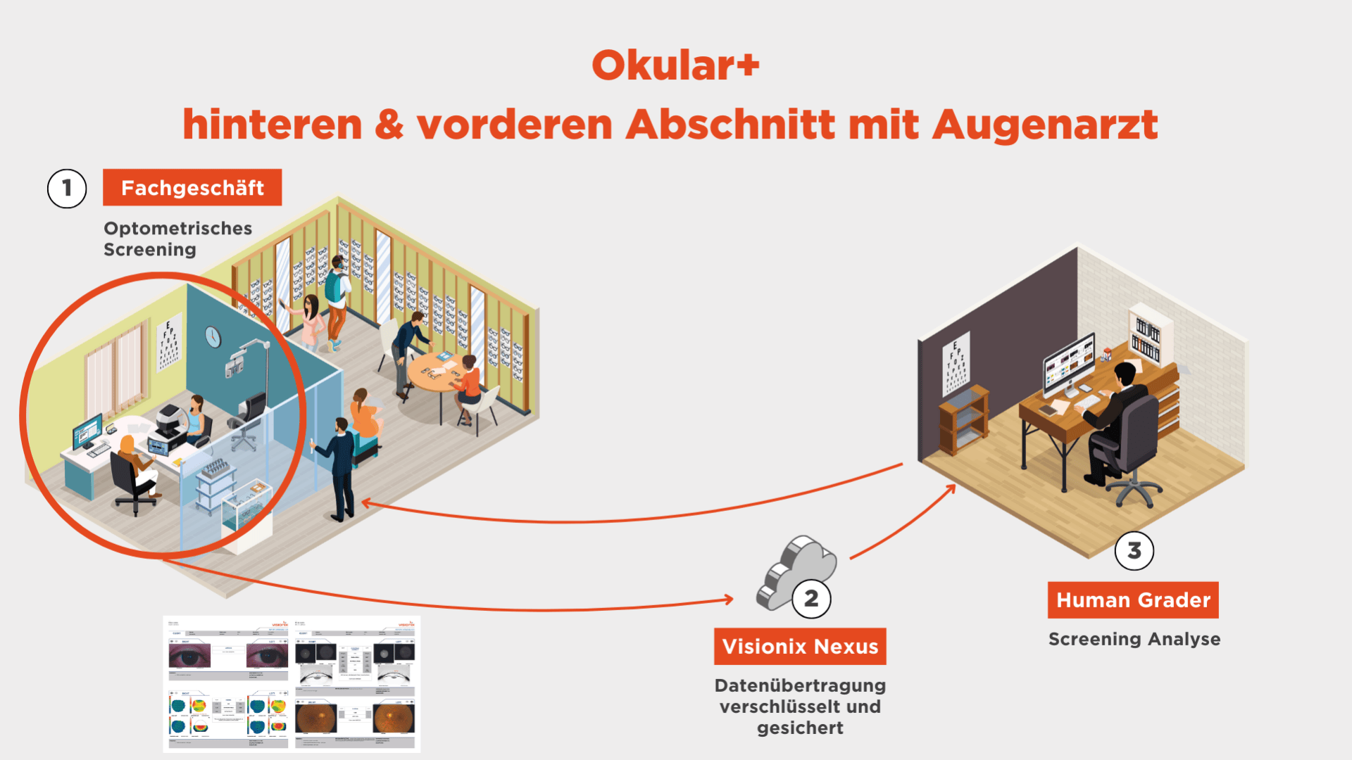 Eine Infografik zeigt drei Schritte: 1) Augenuntersuchung im Geschäft, 2) sichere Datenübertragung über Visionix Nexus, 3) ein Arzt überprüft die Ergebnisse am Computer. Der Prozess verbindet Patient, Technologie und Facharzt aus der Ferne.