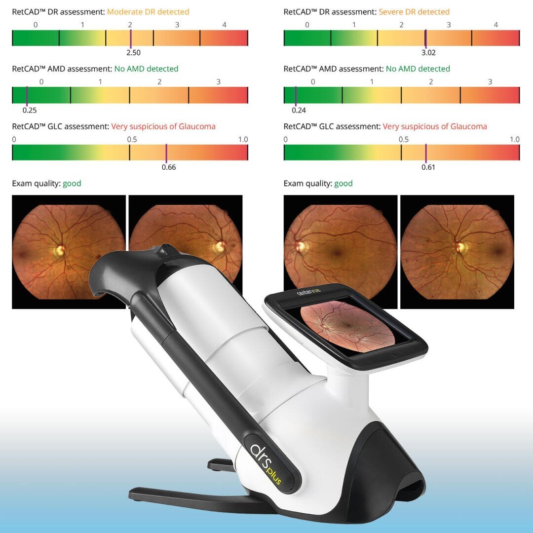 Ein Netzhautbildgebungsgerät ist unter zwei Netzhautscan-Bildern mit Diagnosetabellen abgebildet. Die Diagramme zeigen die Bewertung der diabetischen Retinopathie und des Glaukoms an, wobei die Untersuchungsqualität als gut gekennzeichnet ist.