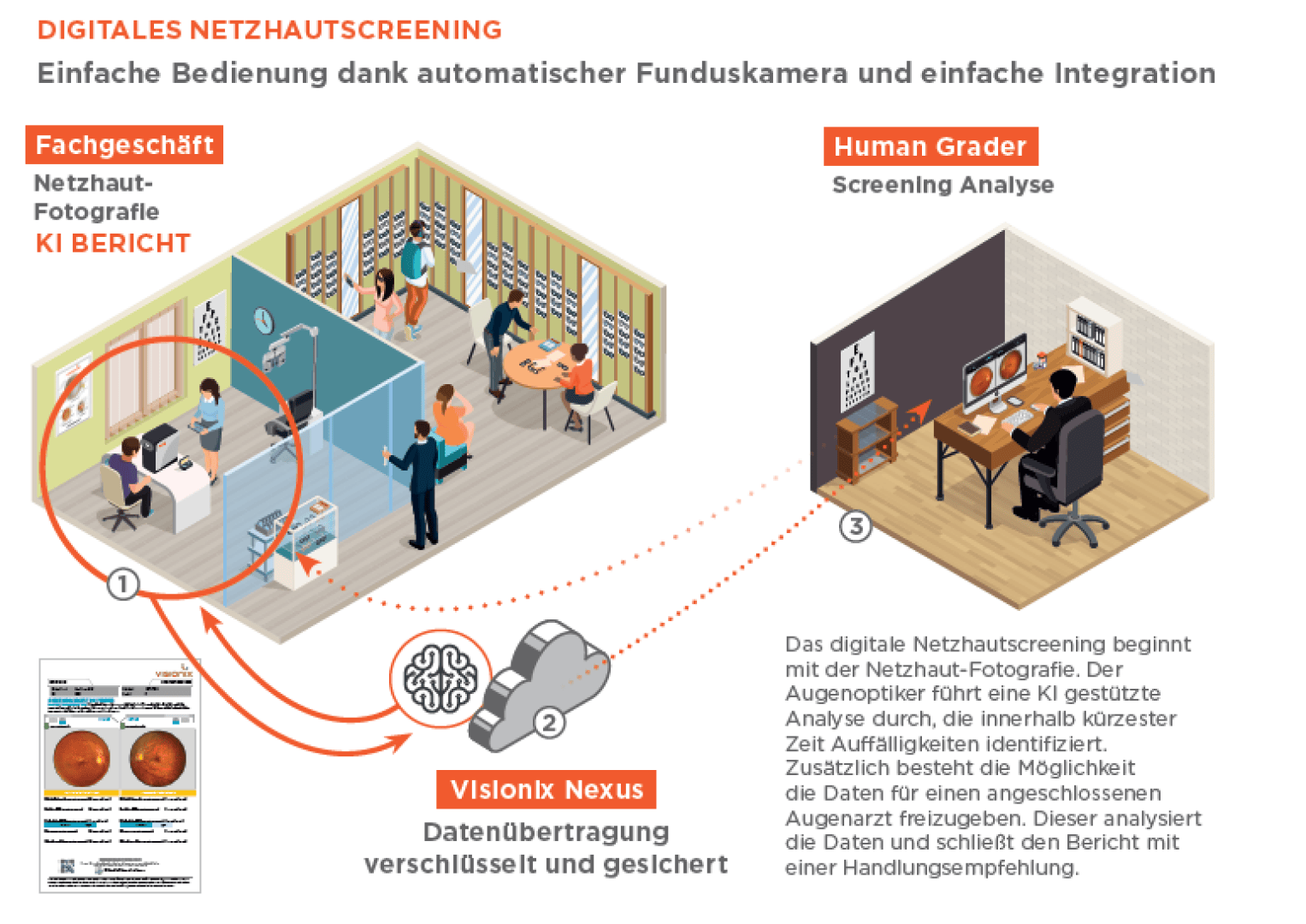 Infografik zum digitalen Netzhautscreening: 1. Augenuntersuchung im Fachgeschäft mit Netzhaut-Fotografie. 2. Analyse am Computer durch Human Grader. 3. Datenübertragung und Auswertung per KI-Bericht.