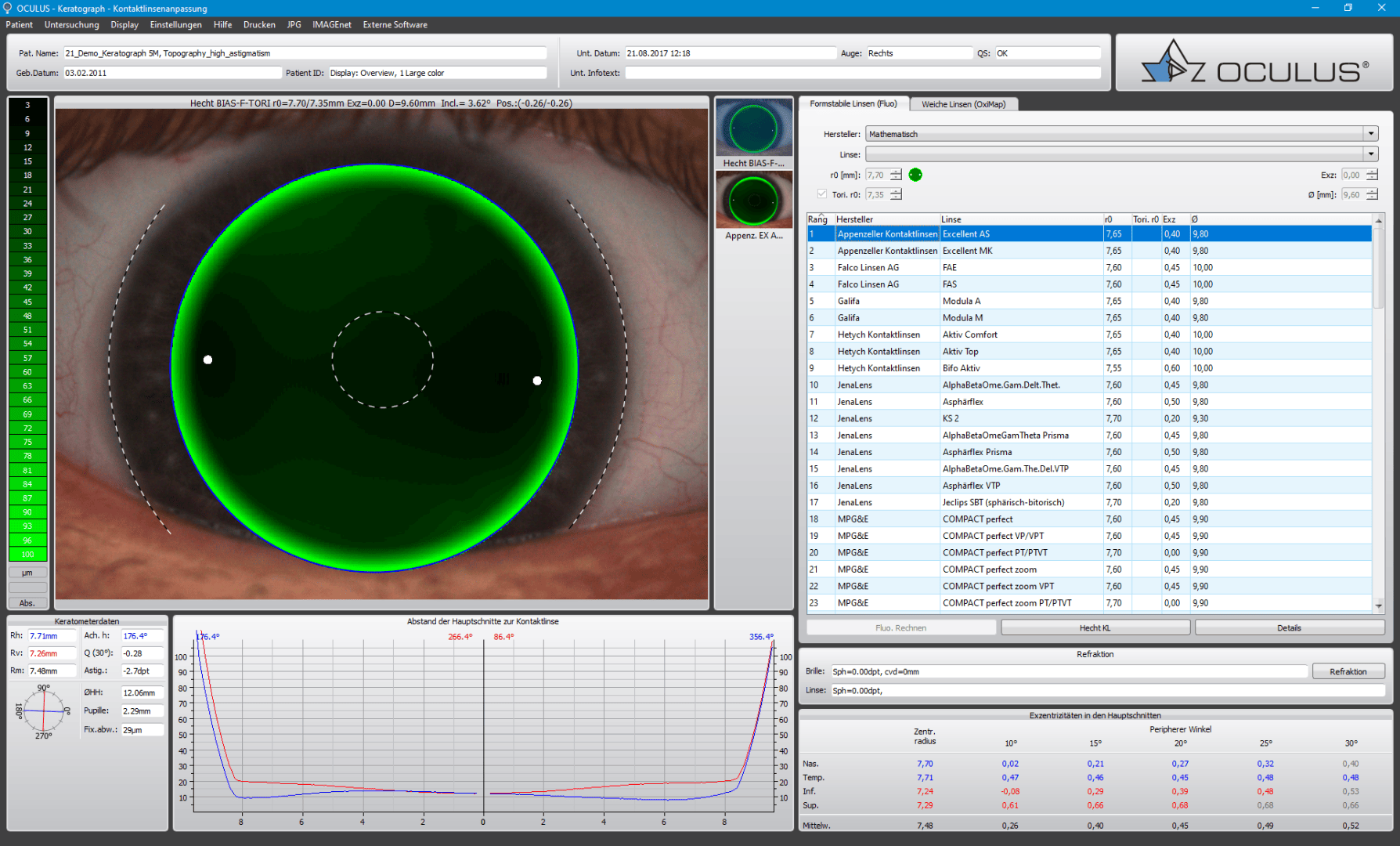 Screenshot einer OCULUS-Augenanalysesoftware, die eine Nahaufnahme des Auges mit einem grünen Overlay, Messdaten auf der rechten Seite, eine Grafik am unteren Rand und Softwaremenüs am oberen Rand anzeigt.