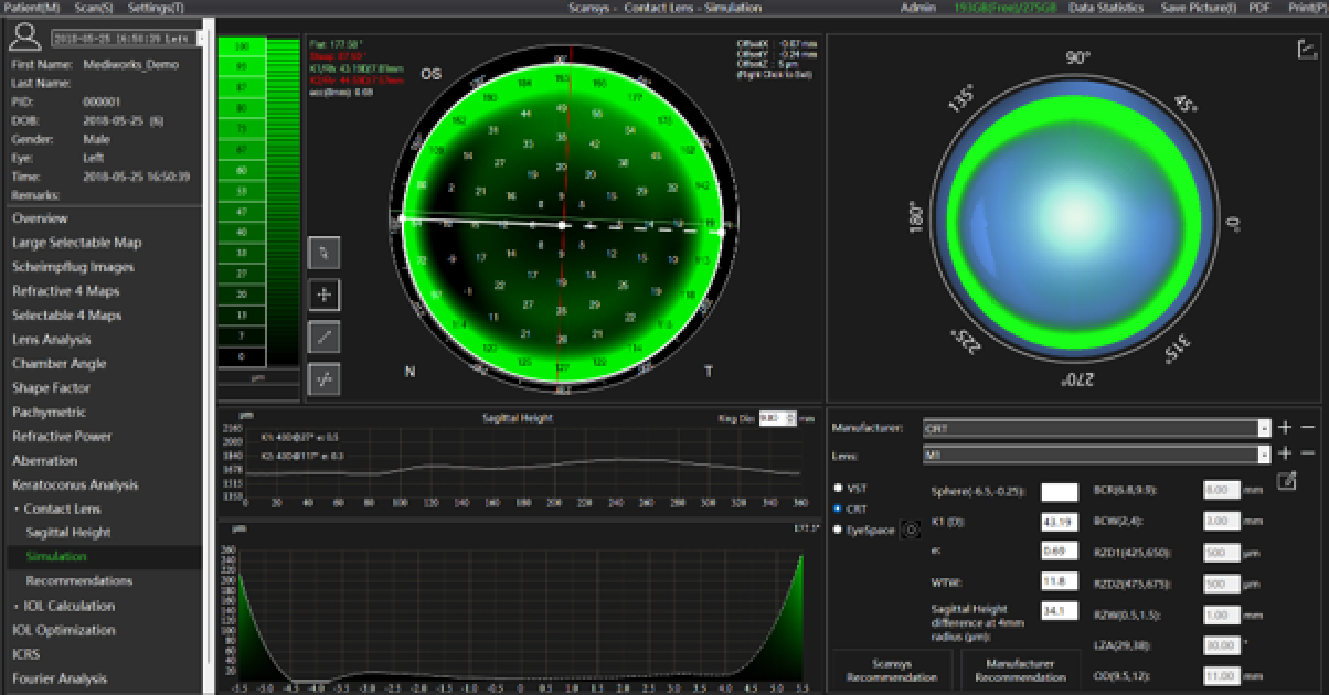 Screenshot of ophthalmic diagnostic software displaying corneal topography data, including a color map, pie charts, sagittal height chart, measurements, and lens recommendations.