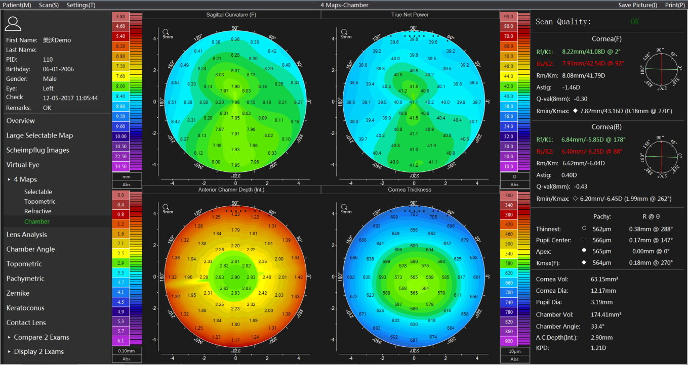 A corneal topography scan displays four color maps and detailed numerical data showing corneal curvature, thickness and elevation for both eyes as well as analysis tools and scan quality indicators on a black background.