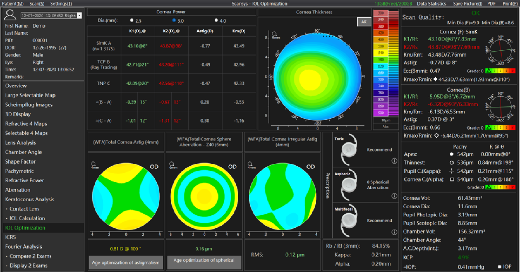 Screenshot of a corneal topography analysis with detailed corneal thickness and thickness maps, color contour plots, numerical data and scan quality metrics on a dark surface for ophthalmic assessment.